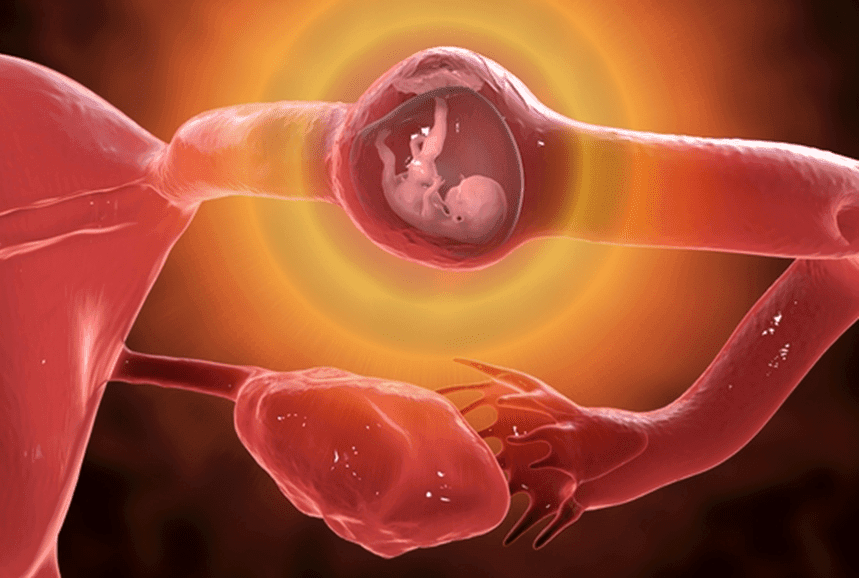 Ectopic Pregnancy Surgery