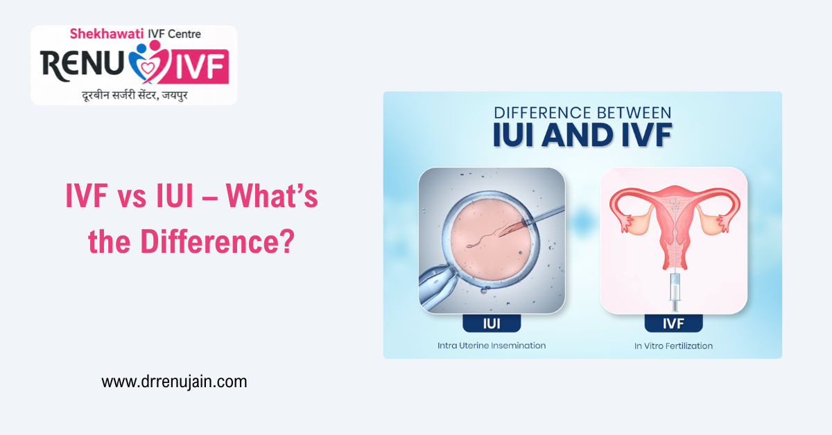 IVF vs IUI – What’s the Difference? A Complete Guide for Couples Trying to Conceive